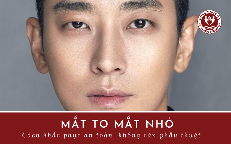 Mắt to mắt nhỏ là bệnh gì? Phương pháp điều trị mắt to mắt nhỏ tại nhà